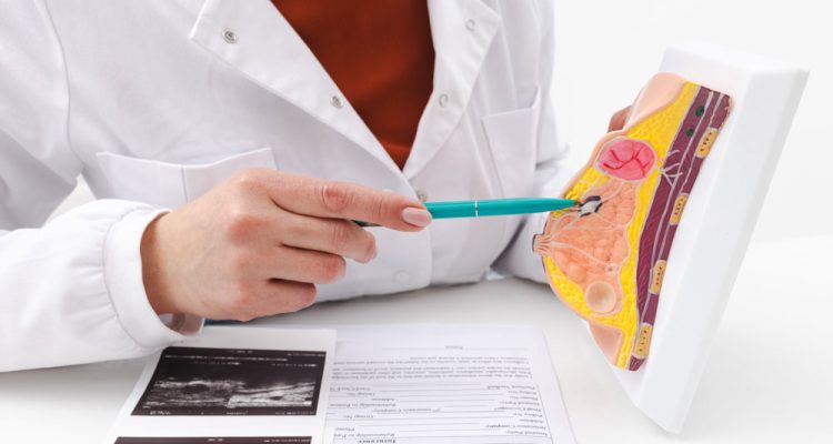 Descubre datos curiosos sobre el cáncer de seno que no conocías. Prevención, hábitos saludables y mitos aclarados en BienEstás 360.